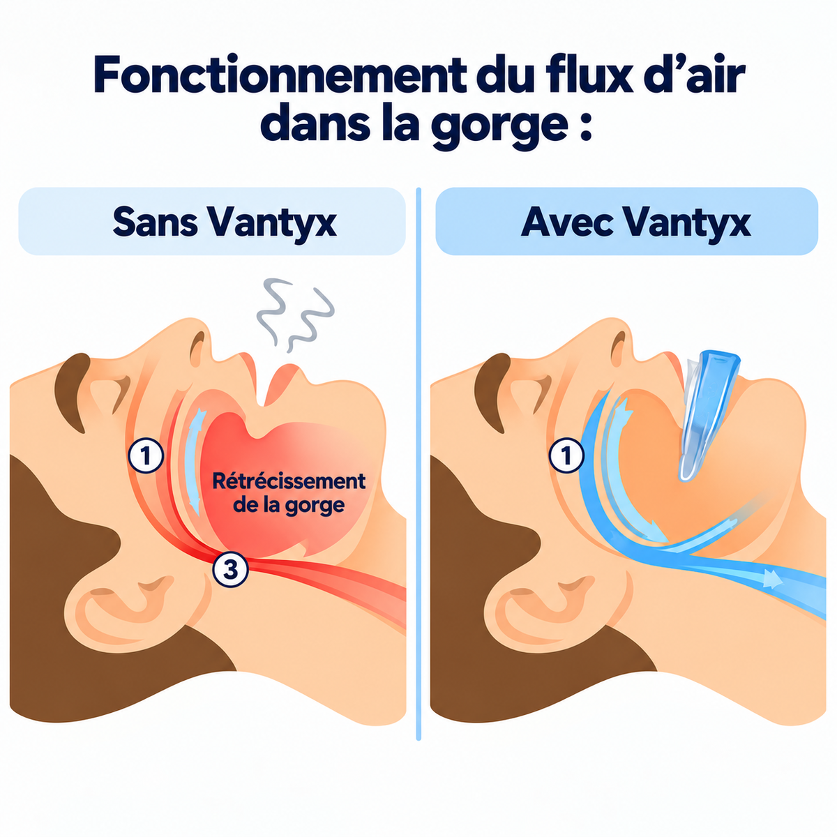 Orthèse Anti-Ronflement Vantyx™